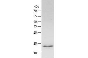 Western Blotting (WB) image for Succinate Dehydrogenase Complex Assembly Factor 1 (SDHAF1) (AA 1-115) protein (His tag) (ABIN7125223) (SDHAF1 Protein (AA 1-115) (His tag))