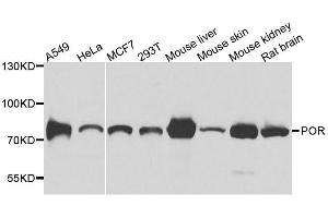 Western blot analysis of extracts of various cell lines, using POR antibody. (POR anticorps  (AA 1-250))