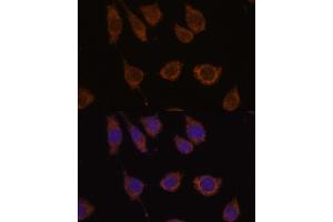 Immunofluorescence analysis of L929 cells using CB antibody (ABIN7266072) at dilution of 1:100.