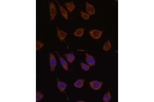Immunofluorescence analysis of L929 cells using CB antibody (ABIN7266072) at dilution of 1:100.