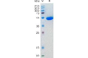 Human IL5 Protein, hFc Tag on SDS-PAGE under reducing condition.