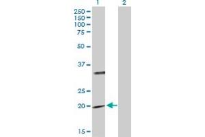 Western Blot analysis of PTPMT1 expression in transfected 293T cell line by PTPMT1 MaxPab polyclonal antibody. (PTPMT1 anticorps  (AA 1-201))