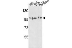 Western Blotting (WB) image for anti-Actinin, alpha 4 (ACTN4) antibody (ABIN3003494) (alpha Actinin 4 anticorps)