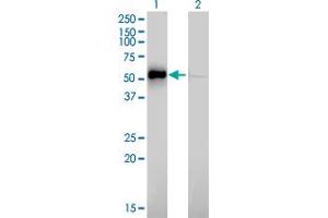 Western Blot analysis of ILK expression in transfected 293T cell line by ILK monoclonal antibody (M01), clone 4F10. (ILK anticorps  (AA 341-452))