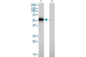 Western Blot analysis of ILK expression in transfected 293T cell line by ILK monoclonal antibody (M01), clone 4F10.