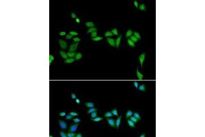 Immunofluorescence analysis of U2OS cells using JADE1 Polyclonal Antibody (PHF17 anticorps)