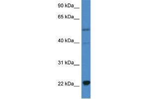WB Suggested Anti-IL18 AntibodyTitration: 1.