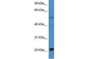 WB Suggested Anti-IL18 AntibodyTitration: 1. (IL-18 anticorps  (C-Term))