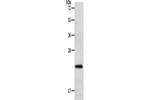 Gel: 12 % SDS-PAGE, Lysate: 40 μg, Lane: Human liver cancer tissue, Primary antibody: ABIN7191632(NEUROG1 Antibody) at dilution 1/400, Secondary antibody: Goat anti rabbit IgG at 1/8000 dilution, Exposure time: 1 minute (Neurogenin 1 anticorps)