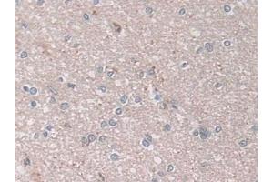 Detection of ASAH1 in Human Cerebrum Tissue using Polyclonal Antibody to N-Acylsphingosine Amidohydrolase 1 (ASAH1)