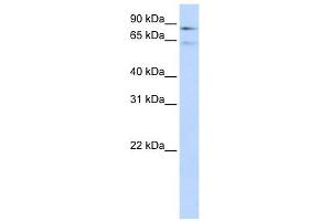 Factor XIII B Polypeptide antibody used at 1 ug/ml to detect target protein. (F13B anticorps  (Middle Region))
