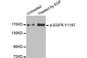 Western blot analysis of extracts from HUVEC cells, using Phospho-EGFR-Y1197 antibody. (EGFR anticorps  (pTyr1197))