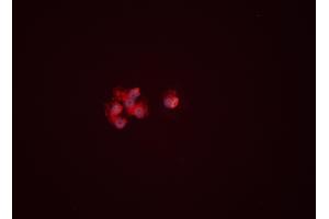 ABIN6261535 and ABIN6276460 staining HEPG2 cells by ICC/IF.