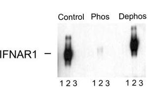 Image no. 2 for anti-Interferon alpha/beta Receptor 1 (IFNAR1) (pSer535), (Ser539) antibody (ABIN228236)