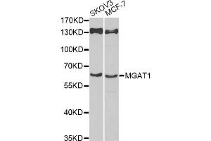 Western blot analysis of extracts of various cell lines, using MGAT1 antibody (ABIN6293367) at 1:1000 dilution. (MGAT1 anticorps)