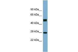 WB Suggested Anti-HOXC8 Antibody Titration: 0. (HOXC8 anticorps  (Middle Region))