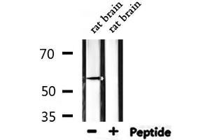 Western blot analysis of extracts from rat brain, using ZSCAN22 Antibody. (ZSCAN22 anticorps  (Internal Region))