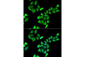 Immunofluorescence analysis of A549 cell using GALE antibody.