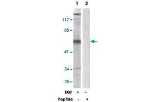Western blot analysis of extracts from NIH/3T3 cells, treated with EGF (200 ng/mL, 30 mins), using STAM2 polyclonal antibody . (STAM2 anticorps)