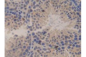 DAB staining on IHC-P; Samples: Mouse Testis Tissue (SSFA2 anticorps  (AA 587-802))