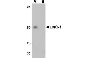 Western Blotting (WB) image for anti-Ectodermal-Neural Cortex 1 (With BTB-Like Domain) (ENC1) (Middle Region) antibody (ABIN1030924) (ENC1 anticorps  (Middle Region))