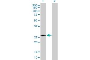 Western Blot analysis of FLJ40504 expression in transfected 293T cell line by FLJ40504 MaxPab polyclonal antibody. (KRT18P55 anticorps  (AA 1-259))