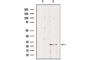 Western blot analysis of extracts from HepG2, using RAB1B Antibody.
