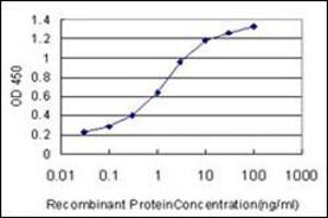 anti-Oculocerebrorenal Syndrome of Lowe (OCRL) (AA 146-240) antibody