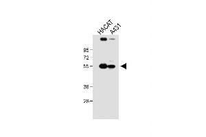 All lanes : Anti-SG Antibody (N-term) at 1:1000 dilution Lane 1: HACAT whole cell lysate Lane 2: A431 whole cell lysate Lysates/proteins at 20 μg per lane. (SGPP1 anticorps  (N-Term))