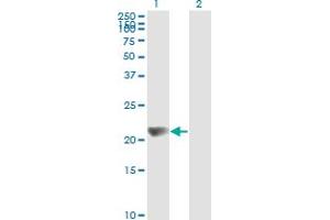 Western Blot analysis of NME1 expression in transfected 293T cell line by NME1 monoclonal antibody (M02), clone 1D7.