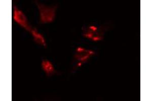 ABIN6274422 staining HeLa cells by IF/ICC. (TBC1D3 anticorps)