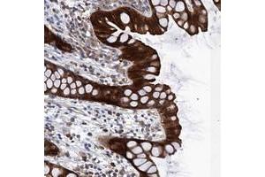 Immunohistochemical staining of human rectum with FAM92B polyclonal antibody  shows strong cytoplasmic positivity in glandular cells. (FAM92B anticorps)