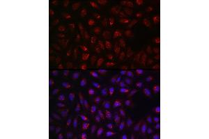 Immunofluorescence analysis of U2OS cells using SDHA Rabbit pAb (ABIN3023399, ABIN3023400, ABIN3023401, ABIN1682638 and ABIN6219706) at dilution of 1:100 (40x lens).