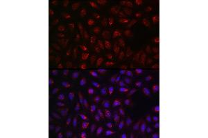 Immunofluorescence analysis of U2OS cells using SDHA Rabbit pAb (ABIN3023399, ABIN3023400, ABIN3023401, ABIN1682638 and ABIN6219706) at dilution of 1:100 (40x lens). (SDHA anticorps  (AA 385-664))