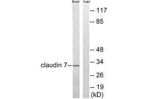 Western blot analysis of extracts from rat liver cells, using Claudin 7 (epitope around residue 210) antibody. (Claudin 7 anticorps  (Tyr210))