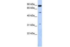 Image no. 1 for anti-SUMO1/sentrin Specific Peptidase 5 (SENP5) (AA 503-552) antibody (ABIN6743841) (SENP5 anticorps  (AA 503-552))