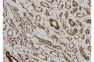 ABIN6272513 at 1/100 staining Human kidney tissue by IHC-P. (MAGEB6 anticorps  (Internal Region))