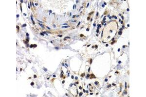 Immunohistochemistry of paraffin-embedded Human normal colon using PKLR Polyclonal Antibody at dilution of 1:200 (40x lens). (PKLR anticorps)