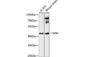 Western blot analysis of extracts of various cell lines, using NFIX antibody (ABIN6129696, ABIN6144568, ABIN6144569 and ABIN6224994) at 1:3000 dilution. (NFIX anticorps  (AA 180-260))