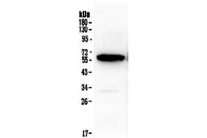 Western blot analysis of Syndecan-1/SDC1 using anti-Syndecan-1/SDC1 antibody . (Syndecan 1 anticorps  (AA 23-254))