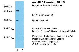 Host: Rabbit  Target Name: KLF2  Sample Tissue: Hela Whole cell  Lane A:  Primary Antibody Lane B:  Primary Antibody + Blocking Peptide Primary Antibody Concentration: 1 µg/mL Peptide Concentration: 5 µg/mL Lysate Quantity: 41 µg/laneGel Concentration:.