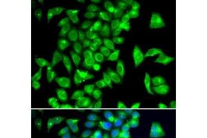 Immunofluorescence analysis of A549 cells using TPH2 Polyclonal Antibody (Tryptophan Hydroxylase 2 anticorps)