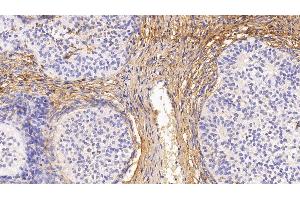 Detection of PIIINP in Human Ovary Tissue using Monoclonal Antibody to Procollagen III N-Terminal Propeptide (PIIINP) (PIIINP anticorps)