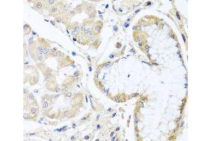 Immunohistochemistry of paraffin-embedded Human stomach using INPP5K Polyclonal Antibody at dilution of 1:100 (40x lens). (INPP5K anticorps)