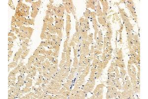 ABIN7094194 and ABIN7098240 at 1/100 staining rat heart tissue by IHC-P. (EHD2 anticorps  (Internal Region))