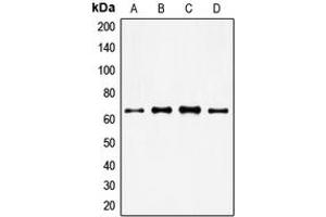 Western blot analysis of FOXO4 expression in HeLa (A), MM142 (B), HuT78 (C), NIH3T3 (D) whole cell lysates. (FOXO4 anticorps  (Center))