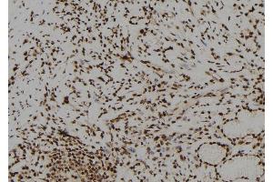 ABIN6278726 at 1/100 staining Human gastric tissue by IHC-P.