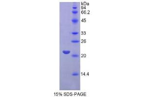 SDS-PAGE (SDS) image for Fibroblast Growth Factor 13 (FGF13) (AA 63-245) protein (His tag) (ABIN1170423)