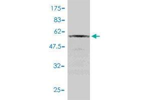 Western Blot detection against Immunogen (52. (RAD51 anticorps  (AA 1-242))