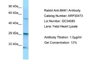 WB Suggested Anti-BAK1 Antibody   Titration: 1. (BAK1 anticorps  (N-Term))